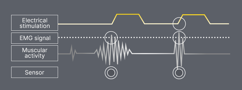 elektrostymulacja noga 2