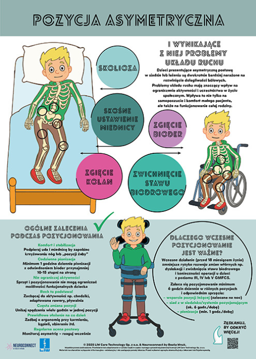 Pozycja_asymetryczna_4.png